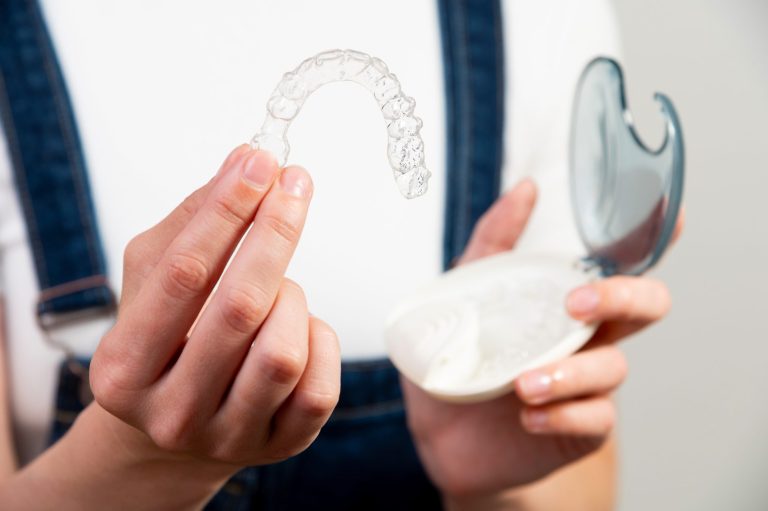 My Retainer Still Fits. Do I Really Need to Wear It Every Night?
